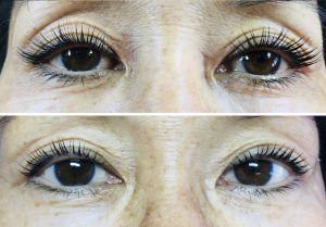 Before/After Eyelash Lift (by stylist Jillian)