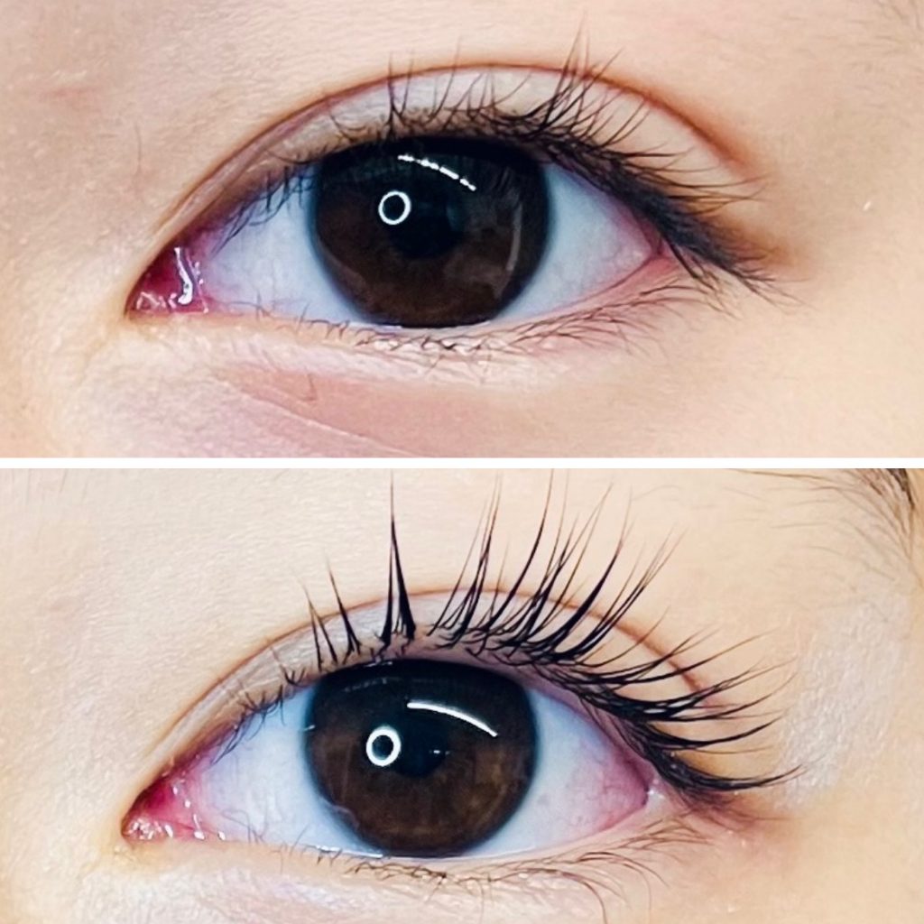 Before/After Eyelash Lift